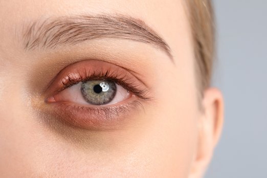 Yeux qui brûlent
